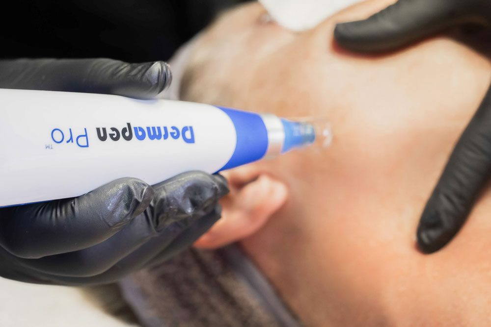 Advanced Skin Treatments